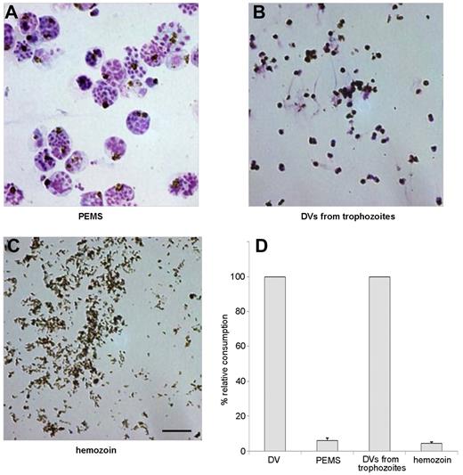 Figure 4. Preparations of PEMSs, intact DVs, and free hemozoin. (A) Merozoites and DVs encased in the parasitophorous vacuole from pRBCs after rupture in the presence of the protease inhibitor E64, which inhibits lysis of the parasitophorous vacuole membrane but not lysis of the erythrocyte membrane. (B) DVs isolated from trophozoites. (C) Hemozoin crystals isolated from sonicated DVs by centrifugation in Percoll. Scale bar indicates 5 μm. (D) Complement consumption tests were performed with materials in panels A through C using 10% NHS. DVs were used as a positive control and similar concentrations of heme were used throughout. Neither PEMSs nor isolated hemozoin had complement-activating capacity. One representative assay of 3 independent experiments is shown, with SD from triplicate determinations.