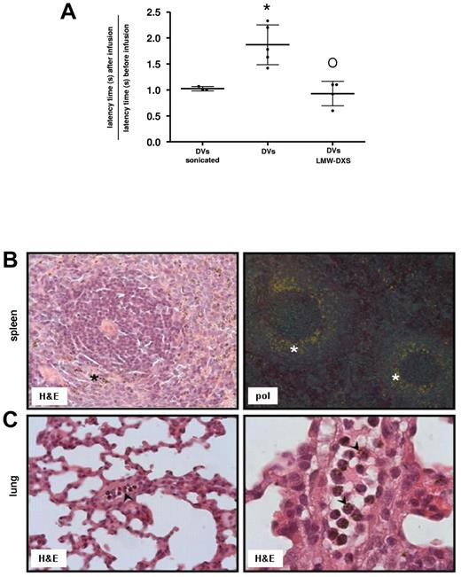 Figure 7. Effect of IV injection of isolated DVs in rats. (A) Reduction of nociceptive responses. The hot-plate test was used, in which rats were placed in jars warmed to 56°C and latency periods until licking of the paws were measured. Results are depicted as the quotient of reaction times measured after DV infusion to reaction times determined before infusion in each animal. One group of animals received a bolus injection of 5 × 109 DVs (n = 5). The second group received an injection of 5 × 109 sonicated DVs (n = 3). The third group received 6 mg of LMW-DXS IP 45 minutes before injection of 5 × 109 DVs (n = 4). All experiments were performed with the same banked DV pool. DVs provoked a significant increase in latency time (*P < .05 vs control), which was significantly decreased in the presence of LMW-DXS (oP < .05). Bars represent the mean values with SD. (B-C) Rapid cellular uptake of DVs by mononuclear cells. Paraffin-embedded sections of spleen (B) and lung (C) were stained with H&E. (B) Intracellular accumulation of DVs in the marginal zone (asterisk) containing abundant macrophages (left panel; magnification 252×). This pattern is illustrated in the right panel after polarization at lower magnification (63×). (C) Intravascular accumulation of PMNs (left panel, arrowhead; magnification 252×) containing intracellular DVs (right panel, arrowhead; magnification 630×).