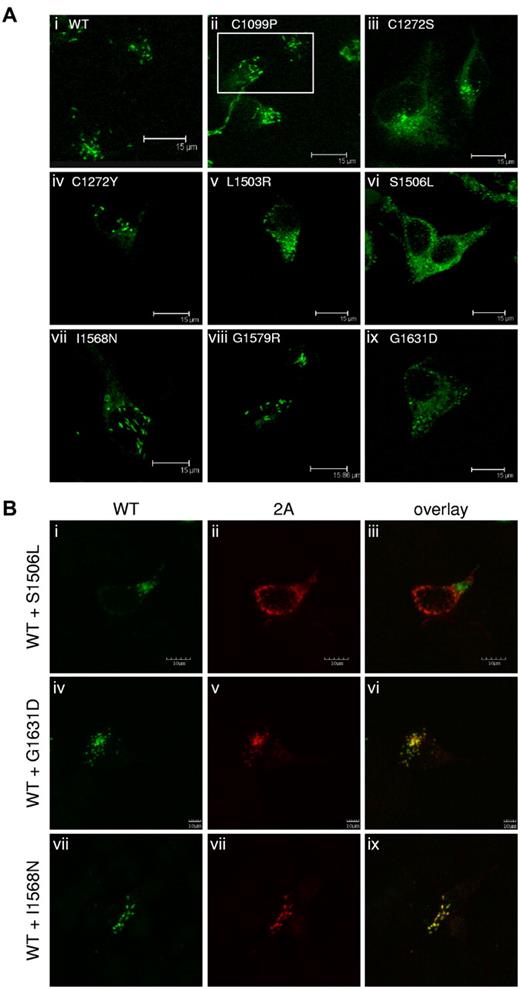 Figure 4. Regulated storage of type 2A variants in HEK293 cells. (A) Type 2A variants were expressed homozygously in HEK293 cells, immunostained, and examined by confocal microscopy, as described in “Immunofluorescent staining.” C1190S (not shown), C1099P, C1272Y, I1568N, and G1579R (ii, iv, vii, and viii, respectively) formed Weibel-Palade body–like storage granules, similar to WT-VWF (A). Variants C1272S, L1503R, S1506L,G1631D (iii, v, vi, and ix) and V1607D (not shown) demonstrated a loss of regulated storage, as indicated by the lack of storage granules and the diffuse staining pattern. (B) Type 2A variants were coexpressed in a 1:1 ratio with WT-VWF in HEK293 cells, immunostained, and examined by confocal microscopy, as described in “Immunofluorescent staining.” Cells expressing both WT-VWF and S1506L (i-iii) demonstrated a loss of Weibel-Palade body–like granules. Cells expressing WT-VWF and G1631D (iv-vi) formed less-elongated granules. WT-VWF storage was not disrupted when cotransfected with I1568N (vii-ix). Regulated storage was disrupted for some type 2A variants.