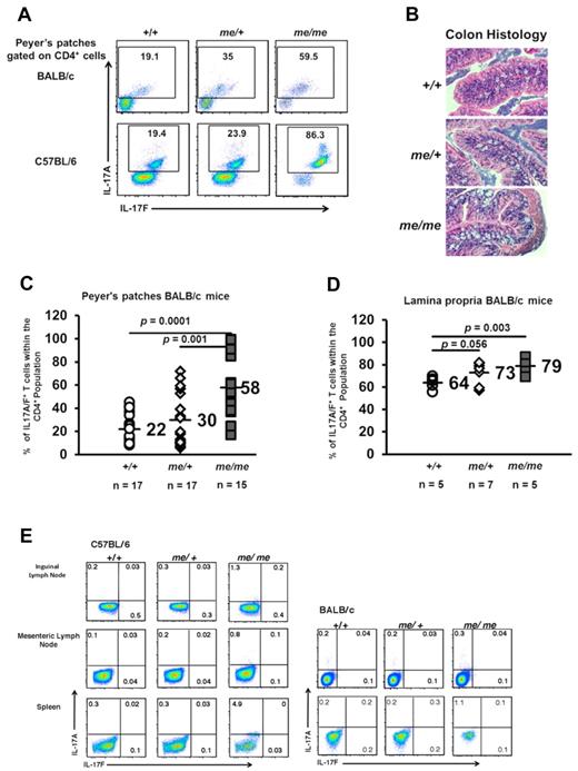 Figure 1. SHP-1 limits natural intestinal Th17 development. (A) IL-17 expression of CD4+ gated T-cell population isolated from the Peyer patches of +/+, me/+, and me/me BALB/c DO11.10 and C57BL/6 mice. +/+ and me/+ mice have comparable numbers of CD4+ cells, whereas me/me mice have 50% reduced CD4+ cell numbers in their Peyer patches correlating with their decreased size (data not shown). (B) Representative colon segments from +/+ (n = 8), me/+ (n = 7), and me/me (n = 8) BALB/c DO11.10 mice (H&E, original magnification ×200). (C-D) Percentages of IL-17A/F+ cells within the CD4+ compartment isolated from the Peyer patches (C) and intestinal lamina propria (D) of mice with the indicated genotypes. (E) IL-17 expression of CD4+ gated T-cell population isolated from inguinal lymph nodes, mesenteric lymph nodes, and spleen of +/+, me/+, and me/me C57BL/6 and BALB/c DO11.10 mice. Data are representative of 2 to 4 independent experiments with multiple mice for each genotype per experiment.