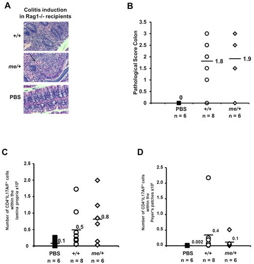 Figure 2. SHP-1–deficient T cells are pathogenic and able to induce colitis. CD4+CD25− CD45RBhi T cells (5 × 105) isolated from +/+ or me/+ mice were transferred into rag1−/− recipients. (A) Representative colon segments of recipient mice 7 to 8 weeks after adoptive T-cell transfer (+/+, me/+, and PBS, H&E, original magnification ×200). The arrow points to a giant cell among inflammatory cells. (B) Pathologic scoring of colon segments from recipient mice 7 to 8 weeks after adoptive T-cell transfer (+/+ vs me/+, P = .5, not significant; +/+ vs PBS, P = .001; me/+ vs PBS, P = .02). (C-D) Numbers of IL-17A/F+ T cells within the CD4+ compartment isolated from the lamina propria (C, +/+ vs me/+, P = .5, not significant) and Peyer patches (D, +/+ vs me/+, P = .7, not significant) of the indicated donor-derived populations 7 to 8 weeks after transfer. Data are representative of 3 independent experiments with multiple mice for each genotype per experiment.