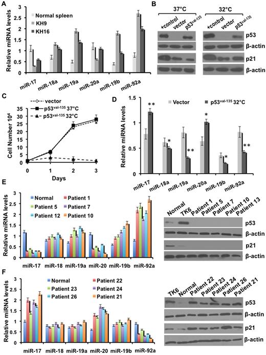 Figure 7. Imbalanced expression of the individual members of miR-17-92 is associated with the loss of p53. (A) Quantitative RT-PCR analysis of individual precursor miR-17-92 expression in the KH9 and KH16 erythroleukemic cell lines derived from p53−/− mice, relative to normal spleens. Each experiment was performed in quadruplicate, where error bars represent SD. (B) p53 and p21 protein expression in SB1 cells transduced to express the p53Val−135 allele or empty vector cultured at 37°C and 32°C, where β-actin was used as a loading control. TK6 human B-lymphoblastoid and NIH-3T3 cells were used as positive controls (+control) for p53 and p21 expression, respectively. (C) Proliferation rates of empty vector control and p53Val−135 transduced SB1 cells, as determined on the indicated days using the Trypan blue exclusion assay. Quantitative RT-PCR analysis of individual precursor miR-17-92 expression in (D) empty vector control and p53Val−135 transduced SB1 cells cultured at 32°C, and (E-F left panel) indicated B-CLL patients displaying a p53− and p53+ signature, respectively. Each experiment was performed in quadruplicate, where error bars represent SD; *P < .05, **P < .005. (E-F right panel) p53 and p21 protein expression in the indicated B-CLL patient samples, where β-actin was used as a loading control. B cells isolated from 5 normal healthy volunteers and the p53+ TK6 cells were used as controls.