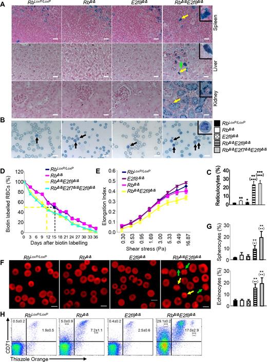 Figure 2. Mx1-Cre–mediated inactivation of Rb and E2f8 in HSCs leads to hemolysis. (A) Prussian blue staining of tissue sections from mice with the indicated genotypes. Yellow arrows indicate a positive macrophage in the spleen, a positive Kupffer cell in the liver, and a positive proximal tubular cell in the kidney, whereas the green arrow indicates a hepatocyte with weak Prussian blue staining. Insets represent enlarged images of representative positive cells. Scale bar indicates 20 μm. (B) Representative images of new methylene blue staining of blood smears prepared from mice with the indicated genotypes. Black arrows show typical reticulocytes on blood smears. The inset shows an enlarged image of a representative reticulocytes. Scale bar indicates 10 μm. (C) Percentages of reticulocytes quantified from panel B. A minimum of 200 RBCs were counted for analysis (n ≥ 3 mice/genotypic group). (D) RBC life spans were assessed by biotin labeling and cytometric analysis (n ≥ 3 mice/genotypic group). (E) RBC deformability was assessed by ektacytometry (n ≥ 3 mice/genotypic group). (F) Representative confocal images of peripheral blood stained with rhodamine-phalloidin. Yellow arrows show spherocytes and green arrows show echinocytes. (G) Quantifications of data from panel F for abnormal erythrocytes (spherocytes and echinocytes). Reticulocytes and leukocytes were excluded from the quantification by counterstaining the peripheral blood with SYTOX Green. Images were acquired on a Zeiss LSM 510 confocal microscope and analyzed with LSM Image Browser Version 4.2 (Carl Zeiss). Scale bar indicates 5 μm. A minimum of 200 cells were counted for analysis (n = 3 mice/genotypic group). (H) Representative flow cytometric profiles using CD71 Abs and Thiazole Orange and percentages of reticulocytes (CD71+TO+) and CD71+ erythrocytes (CD71+TO−) in the peripheral blood. Numbers are mean percentages ± SD (n ≥ 3 mice/genotypic group).