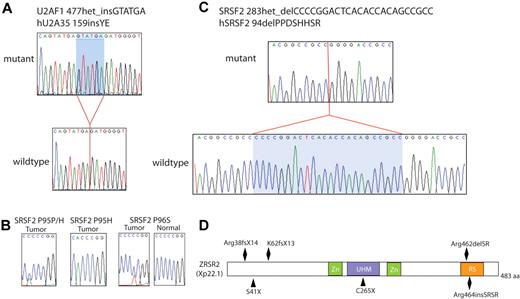 Figure 2. Mutations found with TA cloning. (A) TA cloning found a novel, heterozygous in-frame insertion of 2 amino acids in the region of the previously described recurrent mutation in U2AF1. (B) In addition, a single occurrence of a somatic homozygous SRSF2 P95H mutation was seen as well as a novel missense SRSF2 P96S mutation adjacent to the previously described recurrent heterozygous point mutation at codon P95. (C) A novel, heterozygous 24 nucleotide in-frame deletion in SRSF2 was also found. (D) Multiple previously undescribed mutations were also found in ZRSR2, including several nonsense mutations, N-terminal insertions/deletions that resulted in premature stop codons, as well as in-frame insertions/deletions in the Arginine-serine rich domain.