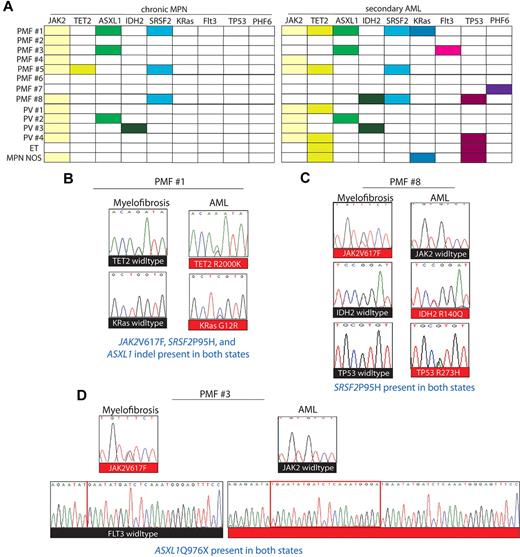 Figure 3. multiple genetic abnormalities at LT found with comprehensive sequencing. Comprehensive sequencing of paired MPN samples that later transformed to AML found multiple genetic abnormalities at transformation as shown by (A) paired MPN/AML mutational diagram as well as (B-D) 3 illustrative cases. For instance, gain of TET2 and KRas mutations (B), loss of JAK2 mutation and acquisition of IDH2 and TP53 mutations (C), and loss of the JAK2 mutation but acquisition of activating mutation in FLT3 could all be observed by comparing chronic MPN and leukemic states. SRSF2 mutations when present in the AML state were always present in the paired antecedent MPN sample. Mutations in c-kit, EZH2, WT1, KRas, HRas, IDH1, U2AF1, SF3B1, ZRSR2, PTEN, RUNX1, and DNMT3a were not seen in either state in this set of patients and hence are not displayed here.