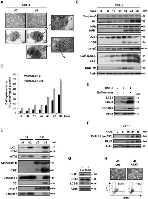 Figure 1. Autophagy is induced during macrophagic differentiation of human monocytes. Human peripheral blood monocytes from healthy donors were exposed for the indicated times to 100 ng/mL CSF-1. (A) Electron microscopy images showing ultrastructural features of a representative monocyte (d0) and morphologic features of autophagy in monocytes treated for 3 days (d3) with CSF-1. P indicates phagophore; A, autophagosome; and N, nuclei. (B) Immunoblot analysis of caspase-3, NPM, LC3, Lamp2, CTSB, and SQSTM1 in monocytes exposed for the indicated times to CSF-1. Actin is used as a loading control. *Cleavage fragments. Molecular weights (MW) are in kDa. (C) Measurement of CTSB and B + L activities using Z-RR-AMC or Z-FR-AMC as substrates, respectively, in monocytes treated with CSF-1. Results, expressed as arbitrary units (A.U.) per minute and per milligram of protein, are the mean ± SD of 4 independent experiments performed in quadruplicate. (D) Monocytes were exposed for 3 days to 100 ng/mL alone or in association with bafilomycin A1 (10nM) added 48 hours after CSF-1 treatment, and protein expression was analyzed by immunoblot. Actin is used as a loading control. (E) Monocytes were exposed for 2 days to CSF-1 before collecting cytoplasmic (F1) and microsomal (F2) extracts that were analyzed by immunoblot. Lamp2 and γ-tubulin are used as a control for microsomal and cytoplasmic fractions, respectively. (F) Immunoblot analysis of phospho-ULK1 (Ser555) and ULK1 in monocytes exposed for the indicated times to CSF-1. (G) Monocytes were transfected with siRNA targeting Luciferase (Luc) or ULK1 and exposed 2 days to CSF-1. The expression of ULK1 in transfected cells was analyzed by immunoblot. (F-G) Actin is used as a loading control. (H) Monocytes were transfected with siRNA targeting Luciferase (Luc) or ULK1 and exposed 2 days to CSF-1. Macrophage differentiation was examined morphologically (fibroblastic shape) and by 2-color flow cytometric analysis. Percentages indicate cells that express both CD71 and CD163.