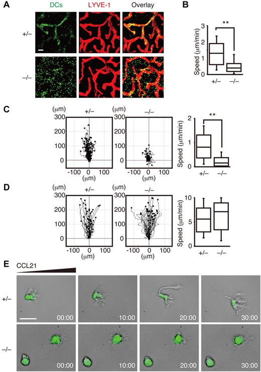 Figure 4. DOCK8 is required for DC migration in 3D, but not 2D, environments. (A) Localization of Dock8+/− and Dock8−/− DCs within the dermis of ear explants after a 90-minute incubation. Scale bar indicates 100 μm. (B) Comparison of the velocity of Dock8+/− and Dock8−/− DCs migrating within the dermis of ear explants. Velocities were determined by analyzing more than 160 cells per group. **P < .01. (C) Migration of LPS-stimulated Dock8+/− (n = 232) and Dock8−/− (n = 194) DCs toward 60 μL of CCL21 source (10 μg/mL) in 3D collagen gels. DC migration was recorded for 120 minutes by time-lapse videomicroscopy. **P < .01. (D) EZ-Taxiscan chemotaxis assay of LPS-stimulated Dock8+/− (n = 47) and Dock8−/− DCs (n = 53) toward 1 μL of CCL21 source (250 μg/mL) on a fibronectin-coated 2D surface. DC migration was recorded for 30 minutes by time-lapse videomicroscopy. (E) Morphology of Dock8+/− and Dock8−/− DCs migrating toward a CCL21 gradient in 3D collagen gels. SYTO12 was used to stain nuclei (green). Elapsed time is presented as minutes:seconds. Scale bar indicates 10 μm. In panels B through D, each box plot exhibits the median (central line within each box), the 25th and 75th percentile values (box ends), and the 10th and 90th percentile values (error bars). Data are representative of 3 (A,C,E) or 2 (D) independent experiments and are from 3 (B) separate experiments.
