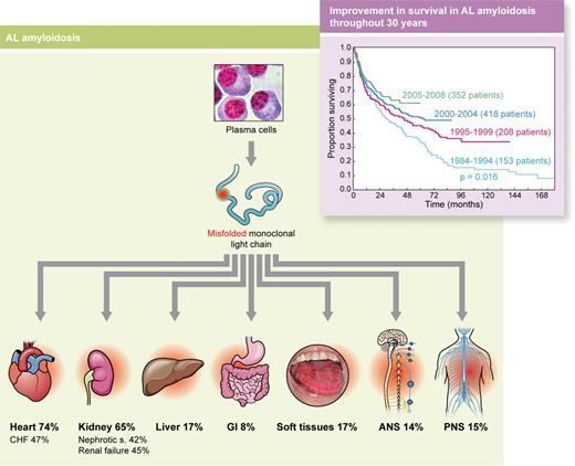 AL amyloidosis is caused by a small or modest, relatively indolent, plasma cell clone secreting light chains (ratio of λ to κ light chains, 4:1) with abnormal folding (misfolded) caused by mutations (symbolized by red dot) that affect critical structural sites. These light chains are prone to aggregation, form amyloid fibrils, and become toxic for cells and tissues, producing failure of vital organs. Heart involvement is the most clinically relevant because it is the cause of death in virtually all patients. Inset: Survival of 1131 patients with AL amyloidosis according to the year of diagnosis followed at the Pavia Amyloid Research and Treatment Center. Although survival continues to improve, the slope of the first part of the curves has not changed during almost 30 years, mostly because of early death of patients with severe cardiac involvement. ANS indicates autonomous nervous system; CHF, congestive heart failure defined as New York Heart Association class III or IV; GI, gastrointestinal tract; and PNS, peripheral nervous system. Professional illustration by Kenneth X. Probst.