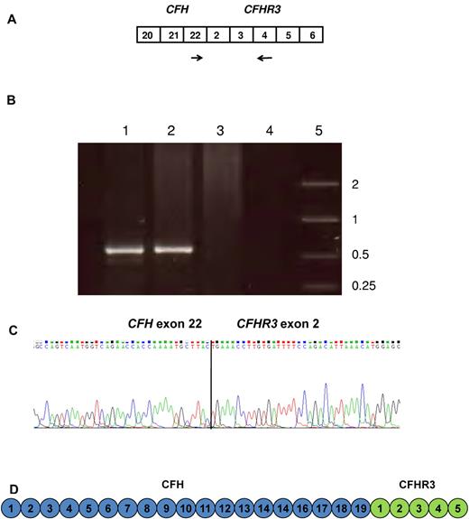 Figure 3. Identification of message from the CFH/CFHR3 hybrid gene. (A) Message for the hybrid CFH/CFHR3 gene was confirmed in cDNA using a forward primer (indicated by the forward arrow) in CFH exon 22 and a reverse primer (indicated by the reverse arrow) in CFHR3 exon 4. (B) Gel showing amplified cDNA. Lanes 1 and 2 show cDNA from IV:5 and V:4 (both affected persons) amplified using a forward primer in CFH exon 22 and a reverse primer in CFHR3 exon 4. Lane 3 shows normal control cDNA amplified with same primers. Lane 4 is a no DNA control. Lane 5 shows a size marker (kb). (C) cDNA sequence confirmed the presence of sequence consistent with a hybrid CFH/CFHR3 gene. (D) The protein product of the CFH/CFHR3 gene is a 24 SCR protein where SCRs 1 to 19 are derived from fH and SCRs 20 to 24 from CFHR3.