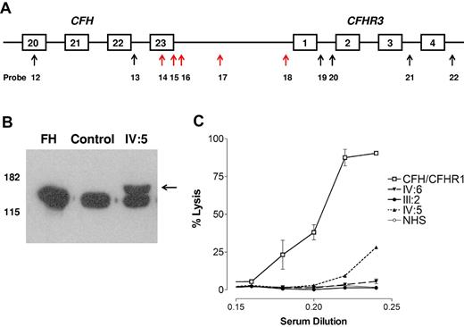 Figure 4. MLPA, Western blotting, and hemolytic assay. (A) MLPA results. The arrows indicate the position of the MLPA probes. Red arrows showed a probe ratio of 0.3 to 0.7. (B) Western blotting. Sera from a control person and one affected person from family A (IV:5) and purified fH (Comptech) were separated on 10% SDS-PAGE and transferred to nitrocellulose. fH was detected as described in “Western blotting.” A higher molecular weight band (indicated by the arrow) is seen in IV:5. (C) Hemolytic assay. Serum from an affected aHUS patient known to carry a heterozygous CFH/CFHR1 hybrid gene lyses the sheep red blood cells in a dose-dependent manner. Serum from an affected person (IV:5) known to carry the CFH/CFHR3 hybrid gene also lyses the cells but to a lesser extent. Sera from 2 unaffected persons (III:2 and IV:6) who carry the CFH/CFHR3 hybrid gene does not lyse the cells.