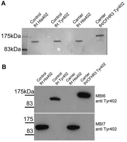 Figure 5. Purification of fH and fH/CFHR3. Monoclonal antibodies specific for fH-402Tyr or fH-402His were coupled to HiTrap affinity columns and used to separate the allelic fH variants from a heterozygote control or the carrier IV:6 (the latter carried the mutated protein on the CFH402Y allele). The purified protein was eluted from the column, concentrated, and subjected to size exclusion on a Supedex 200 column (supplemental Figure 2). The purified proteins were analyzed by SDS-PAGE (A) and by Western blot with allele-specific monoclonal antibodies (B). This Western blot confirms that the mutant protein is encoded on the fH-402Tyr allele and illustrates that there is no cross-contamination of the protein preparations.