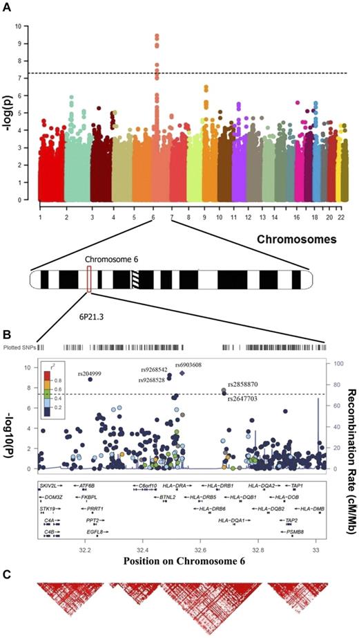 Figure 1. Results of a meta-analysis of 2 GWAS on 393 cases and 3315 controls. (A) Manhattan plot of the genome-wide results. P values were determined for each SNP based on the meta-analysis of the UC and USC samples. Five SNPs surpassed the genome-wide significance threshold (P value = 5 × 10−8): rs9268542, rs9268528, rs204999, rs2858870, and rs6903608 6p21.3. (B) Regional plot of the 6p21.3 for the combined genome-wide association results. The blue lines represent recombination rates. The previously reported SNP rs6903608 is designated by a diamond; all other SNPs are depicted by circles. (C) Linkage disequilibrium map of the 6p21.3 region (red represents r2 > 0.9).
