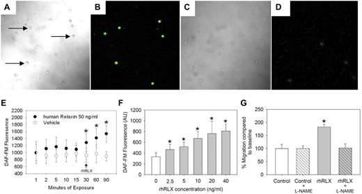 Figure 2. CD34+ BMDECs produce NO in response to rhRLX. Human CD34+ BMDECs were isolated in the absence (A-B) and presence (C-D) of 100μM L-NAME and then incubated with DAF-FM before imaging by confocal microscopy. Panels A and C are brightfield images of panels B and D, respectively, the same fields imaged with 495 nm excitation and 515 nm emission. Arrows indicate some of the CD34+ BMDECs. Original magnification ×200. (E) CD34+ BMDECs were isolated from a healthy volunteer and labeled with DAF-FM for 30 minutes before removing probe and waiting 10 minutes for de-esterification. The cells were monitored for 30 minutes, to confirm a stable baseline of bioavailable NO before vehicle (○; arrow) or 50 ng/mL of rhRLX (●; arrow) was added to the CD34+ cells. Shown is the mean fluorescence (± SD) of at least 8 cells in which fluorescence was continuously monitored. *P < .01 versus last baseline value. (F) BMDEC-CFU were isolated from a healthy volunteer and labeled with DAF-FM. After 30 minutes to stabilize NO baseline, the indicated concentration of rhRLX was added and after 30 minutes fluorescence was determined. Data are mean ± SD. *P < .001 versus 0 ng/mL of rhRLX. (G) Cells were incubated with 10μM L-NAME before being placed in the Boyden chamber with 50 ng/mL of rhRLX. The mean percentage (± SD) of fluorescence of cells migrating relative to control is shown. *P < .001 versus all other treatments.