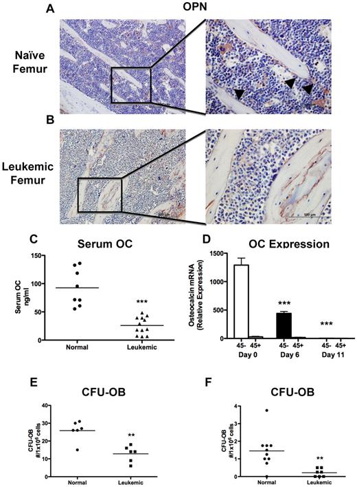 Figure 2. Leukemia decreases osteoblastic number and function. (A-B) Osteopontin immunohistochemistry was performed on paraffin-embedded sections. Representative images are shown of (A) a naive femur and (B) a leukemic femur. Left panels 20×, and right panels 60× objectives. Osteopontin+ cells are stained brown, and sections were counterstained with hematoxylin (blue). Arrowheads indicate osteopontin+ cells. (C) Quantification of serum osteocalcin measured by ELISA. (D) Real-time RT-PCR quantifying osteocalcin RNA expression in osteoblast-like cells collected from the long bones of normal or leukemic mice at day 6 or 11 and magnetically separated based on CD45 expression. Statistical significance was determined compared with naive mice (day 0). n = 5 samples per experimental group. (E-F) CFU-OBs formed per well from (E) whole marrow after 28 days in culture and (F) cells collected by collagenase digestion of bone fragments after 15 days in culture. **P ≤ .01. ***P ≤ .001.