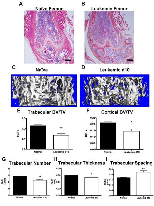 Figure 3. Leukemic environment induces bone loss. (A-B) Representative images of H&E-stained paraffin sections of the distal femur from a (A) naive and (B) leukemic mouse 10 days after transplantation, 4× objective. (C-D) Representative micro-CT images from the metaphysis of the femur from (C) naive and (D) leukemic mice. (E) Micro-CT analysis of femur trabecular bone volume/total volume. (F) Femur cortical bone volume/total volume. (G) Trabecular number. (H) Trabecular thickness. (I) Trabecular spacing. *P ≤ .05. **P ≤ .01. n = 4 mice per experiment.