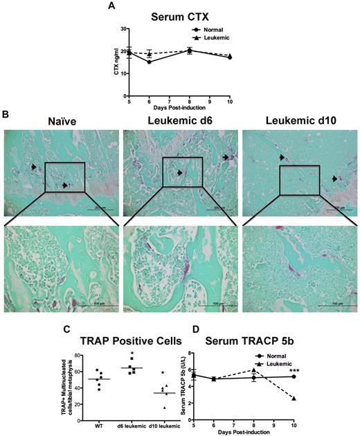 Figure 4. Leukemic environment mildly and transiently increases osteoclastic numbers in vivo. (A) Serum levels of carboxy-terminal collagen cross-link CTX, a marker of bone resorption as measured by ELISA. (B) Representative images of paraffin sections stained for the osteoclastic marker TRAP. TRAP+ cells are pink and highlighted by arrowheads. Top panels 20×, and bottom panels 60× objectives. (C) Quantification of multinucleated TRAP+ cells in a 1-mm2 area just proximal of the distal growth plate in the femur from sections represented by the panels in B. (D) Serum levels of TRACP 5b, the osteoclast specific TRAP enzyme, measured by ELISA. *P ≤ .05. ***P ≤ .001. Each point indicates an individual mouse in this and subsequent experiments; n = 5 mice per experiment.
