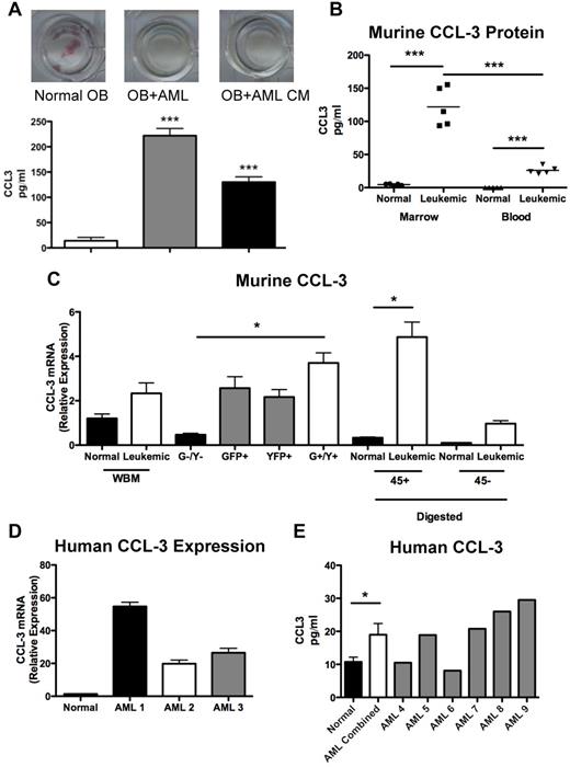 Figure 7. CCL-3 expression is increased in malignant cells from leukemic mice. (A) Top panel: Representative wells from CFU-OB cultures stained for alkaline phosphatase activity (pink). Bottom panel: CCL3 levels in culture media from CFU-OB cultures. (B) CCL3 protein levels in murine model of AML compared with normal controls. (C) Relative expression of CCL3 in bone marrow mononuclear cells isolated from whole bone marrow, cells sorted for GFP and YFP expression according to Figure 1D, and cells liberated from bone fragments by collagenase digestion and magnetically separated based on CD45 cell surface expression. (D) Relative expression of human CCL3 in primitive CD34+CD38−CD123+ AML cells compared with normal controls. Each bar represents a single AML sample normalized to 3 normal controls. (E) CCL3 protein levels in human AML patient marrow plasma. Each bar represents a single AML marrow sample compared with 7 normal controls. *P ≤ .05. ***P ≤ .001. (A-B,D) Each data point represents an individual mouse. (C) n = 3 mice per treatment group.