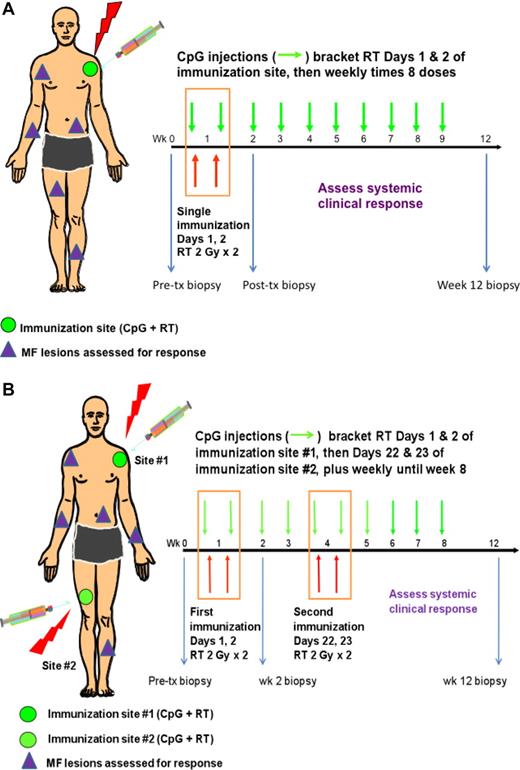 Figure 1. Treatment schema. The single immunization procedure (A) consisted of irradiating a single MF skin lesion on days 1 and 2 (2 Gy each day) along with intratumoral injection of CpG within an hour before the day 1 and after the day 2 RT. CpG was then injected into the same site weekly for an additional 8 doses for a total of 10 doses. From patient 7 (B), a boost immunization was delivered at a distant MF lesion at week 4, and weekly CpG injections were performed at that site until completion of 10 doses. Systemic clinical response was assessed by mSWAT of nonimmunized MF lesions weekly until week 8 and then at week 12. Correlative skin samples were obtained from the immunization site at baseline and week 2.