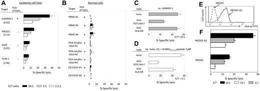 Figure 4. AURKA207-215–specific TCR-transduced CD8+ T cells can distinguish leukemia cells from normal cells on the basis of AURKA expression levels. (A) AURKA207-215–specificTCR-transduced CD8+ T cells exhibit antileukemia reactivity in an HLA-A*0201-dependent fashion. The HLA-A*0201+ leukemia cell line GANMO-1 was lysed by AURKA207-215–specificTCR-transduced CD8+ T cells as a function of effector:target (E/T) ratio; no significant lysis was observed with the HLA-A*0201− leukemia cells lines MEG01, KAZZ and OUN-1. All of the tested leukemia cell lines overexpress AURKA mRNA; numbers in parentheses indicate AURKA mRNA expression relative to K562, and correlations with AURKA protein expression are shown in supplemental Figure 2. (B) The same AURKA207-215–specificTCR-transduced CD8+ T cells used in panel A at the same E/T ratios were tested in 51Cr-release assays for potentially damaging effects against normal cells. No significant lysis was observed with HLA-A*0201+ PBMCs (n = 3), PHA-lymphoblasts representing normal mitotic cells (n = 3) or normal cord blood–derived CD34+ cells (CB-CD34+) encompassing normal hematopoietic progenitor cells (n = 2). AURKA mRNA expression relative to K562 was 0.02 ± 0.008 for PBMCs, 0.25 ± 0.005 for PHA-lymphoblasts and 0.21 ± 0.09 for CB-CD34+ cells (* indicates less than detectable). (C) Effects of HLA class I and class II blockade on the cytotoxic activity of AURKA207-215–specificTCR-transduced CD8+ T cells against GANMO-1 leukemia cells. E/T, effector:target ratio. (D) As for panel C, showing the effects of HLA class I and class II blockade on the lysis of autologous B-LCLs loaded with AURKA207-215 peptide (1μM). (E) Flow cytometric confirmation of HLA-A*0201 expression by MEG01-A2 cells. (F) Enhanced lysis of MEG01-A2 cells relative to parental MEG01 cells by AURKA207-215–specificTCR-transduced CD8+ T cells confirms recognition of endogenously processed AURKA207-215 peptide presented in the context of HLA-A*0201. E/T indicates effector:target ratio. Error bars represent SDs.