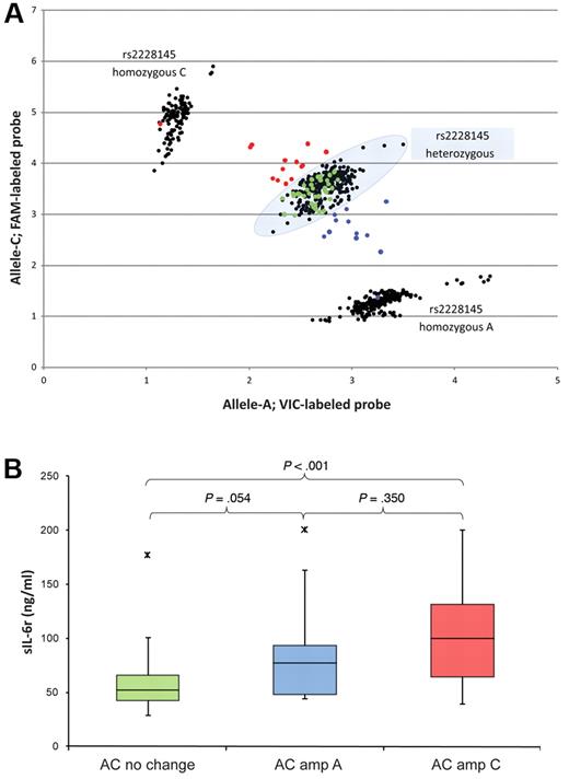 Figure 6. Effects on serum sIL-6r concentrations by LOH in 64 baseline MM patients. (A) Scatter plot of rs2228145 genotype in 626 PBSC (black) and 64 PC (red, green, and blue) samples; the heterozygous group is identified by the shaded oval. The 64 patients used for loss of heterozygosity analysis were identified as heterozygous in germ line samples. Of the 64 PC samples, 38 showed no sign of allele change by scatter plot (green; AC–No change), 14 showed a gain of allele C (red; AC–Amp C), and 12 showed a gain of allele A (blue; AC–Amp A). (B) Serum sIL-6r levels in the 64 patients, segregated by allele change and color-coded to match panel A.