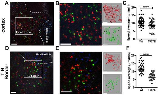 Figure 4. Slower migration of ezrin T567E transgenic T cells in lymph node in vivo. One day before imaging, WT B-lymphocytes, which were stained with blue (CMF2HC), were injected to delineate B-cell follicles. T-lymphocytes from WT mice were stained red (CMTMR) and from ezrin T567E transgenics were stained green (CMFDA), mixed, injected intravenously, and migration in inguinal lymph node was assessed 18 hours later by 2-photon microscopy. (A) Image of region of central T-cell cortex marking representative region for analysis. Bar represents 100 μm. (B) Frame from region analyzed along with tracks of WT (green) and ezrin T567E transgenic (red). Bar represents 30 μm. (C) Summary of migration speed of individual cells shows lower average speed of ezrin T567E transgenic lymphocytes (P < .0001). Data are mean ± SEM: WT (10.8 ± 0.3 μm/s; N = 55), Tg (8.7 ± 0.4 μm/s; N = 40). (D-F) Comparable analyses of migration near the border between T-cell area and B-cell follicle. Migration speed mean ± SEM: WT (12.2 ± 0.5 μm/min; N = 39), Tg (6.4 ± 0.3 μm/min; N = 30). All P values were calculated using the Mann-Whitney test in Prism Version 5 (GraphPad). ***P < .0001.