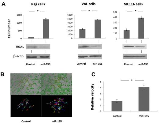 Figure 2. miR-155 increases lymphoma cell motility. (A) Raji, VAL, and MC116 cells were transfected with hsa-miR-155 or nontargeted control. Forty-eight hours later, the cells were used for SDF-1 chemotaxis assay performed in triplicate, as described in “Chemotaxis assays.” Data are mean ± SE. *Significant difference (P < .05). Western blot confirms down-regulation of HGAL protein levels in the hsa-miR-155–transfected cells. (B) Representative pictures demonstrating spontaneous movement paths of Raji cells, transfected with hsa-miR-155 or with nontargeted control. Forty-eight hours after transfection, cells were seeded on fibronectin-coated 6-well plates. Time lapse images were acquired every 2 minutes for 1 hour. Top portion: Motility tracks (in green) of selected cells (in red). Bottom portion: Motility tracks of 50 randomly selected cells over 1 hour, measured, and graphed using the Track Points. Each track was assigned a different random color. Timelapse images were acquired with a BD Pathway 855 HCS Bioimager (BD Biosciences) with an Olympus 10×/0.3NA objective lens and ORCA-ER CCD camera. Images were saved as 1344 × 1024 pixel TIFF images, opened in MetaMorph 5.07 (Universal Imaging–Molecular Devices) and generated the video and measured and graphed using Track Points. Data was exported to Microsoft Excel 2007 by dynamic data exchange. (C) Average velocity of 50 cells in each treatment group. *Significant difference (P < .05). Error bars represent SEM.