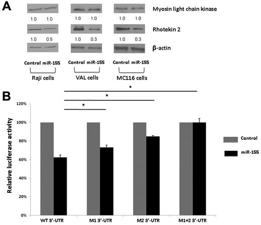 Figure 5. miR-155 regulates expression of RTKN2. (A) Effect of hsa-miR-155 overexpression on native RTKN2 and myosin light chain kinase protein levels in Raji, VAL, and MC116 cell line at 48 hours after transfection, assessed by Western blot. Actin levels were used as loading control. Densitometry analysis of normalized RTKN2 and myosin light chain kinase protein to actin are presented. The values in the control samples were arbitrarily defined as 1. Results are representative of 3 independent experiments. (B) Dual luciferase activity of reporter plasmids with the wild-type or mutated 3′-UTR of RTKN2 fused to the luciferase gene following hsa–miR-155 cotransfection in HeLa cells. The black columns represent cotransfections with hsa–miR-155; and the gray columns, the cotransfection of the same reporter vector with the nontargeting control. Mutations of the putative binding sites are represented as M1 and M2 3′-UTR and concomitant mutation of both sites as M1 + 2 3′-UTR. Values are normalized to the value of each control, which is noted as 100%. *Significant difference (P < .05). Error bars represent SEM.