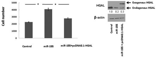 Figure 6. HGAL mediates miR-155 effects on human lymphoma cell motility. VAL lymphoma cells were transfected with control nontargeting miRNA and hsa-miR-155 alone or with pcDNA3.1-HGAL plasmid. Forty-eight hours later, the cells were used for SDF-1 chemotaxis assay performed in triplicate, as described in “Chemotaxis assays.” Data are mean ± SEM of triplicates. *Significant difference (P < .05). Western blot confirms down-regulation of endogenous HGAL protein levels in hsa-miR-155–transfected cells and rescue of HGAL expression in cells transfected with pcDNA3.1-HGAL plasmid. Densitometry analysis of normalized endogenous HGAL to actin is presented. The values in the control samples were arbitrarily defined as 1. Results are representative of 2 independent experiments.