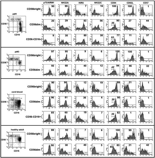 Figure 4. Surface phenotype of CD56brightCD16−/low, CD56dimCD16+, and CD56−CD16+ NK-cell subsets reconstituting after intrabone UCBT. Purified NK cells were stained with anti-CD56 and anti-CD16 mAbs to identify 3 subsets: CD56brightCD16−/low, CD56dimCD16+, and CD56−CD16+. Each of the 3 gated populations was assessed for the expression of the indicated surface Ags. In each histogram the percentage of positive cells is shown. The number in italics indicates the percentage of CD56dim or CD56−CD16+ NK cells expressing the CD94dim phenotype. A representative patient of group 1 and 1 of group 3 are shown in the first and second panels, whereas a CB and a healthy adult are shown in the third and fourth panels, respectively. The phenotype of CD56−CD16+ is not reported for group 3 patients and adult donors because in these 2 cases this NK subset was substantially undetectable.