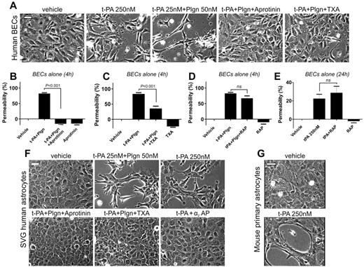 Figure 4. t-PA causes marked morphologic and functional changes in both brain endothelial cells (BECs) and astrocytes via plasmin. (A) Representative phase contrast images of human BECs 12 hours after stimulation with t-PA (250nM) alone or t-PA (25nM) + Plgn (50nM) in the absence or presence of aprotinin (2μM) or TXA (10mM). Aprotinin and TXA fully block t-PA/Plgn–mediated changes in endothelial cell morphology, suggesting that cell surface–associated active plasmin is responsible for this effect. Scale bars represent 40 μm. (B-E) Permeability analysis of BECs alone on porous membranes 4 hours after stimulation by luminal addition of t-PA (25nM) and Plgn (50nM) with or without aprotinin (2μM; n = 3-7; B), TXA (10mM added to the luminal and abluminal chambers; n = 5; C), or RAP (0.5μM; n = 6; D). The effect of t-PA (250nM) alone or in combination with RAP (0.5μM) after 24 hours is shown in panel E (n = 4). Hence, endothelial cell permeability is also strongly influenced by cell surface–bound, active plasmin. (F) Phase-contrast images of SVG human astrocytes 16 hours after treatment with vehicle, t-PA (25nM) + Plgn (50nM) with or without aprotinin (2μM) or TXA (10mM) or with t-PA (250nM) alone, or in combination with 250nM α2AP. Scale bars represent 40 μm. (G) Phase-contrast images of primary mouse astrocytes 16 hours after treatment with vehicle or t-PA (250nM) alone. Both human SVG and mouse astrocytes undergo marked morphologic changes after treatment with t-PA/Plgn. Scale bars represent 40 μm.