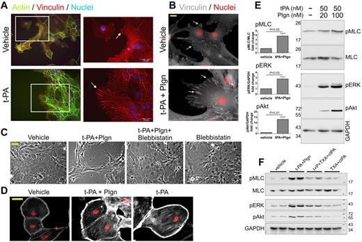 Figure 5. Treatment with t-PA/Plgn causes marked changes in the actin cytoskeleton, an increase in focal adhesion size, and generation of contractile forces in primary mouse astrocytes. (A) Representative immunofluorescence images of primary mouse astrocytes showing changes in F-actin and focal adhesion after treatment with t-PA (1μM) or its vehicle. Marked increase in stress fiber formation (left images, green) and vinculin size (right magnified images, red, indicated by arrows) are demonstrated after treatment with t-PA. Nuclei appear in blue. Scale bars represent 20 μm. (B) Representative immunofluorescence images of primary mouse astrocytes demonstrating changes in focal adhesion 24 hours after treatment with t-PA (50nM) + Plgn (20nM). Marked increase in vinculin (white, arrows) dimension is observed. Nuclei appear in red. Scale bars represent 20 μm. (C) Phase-contrast images of primary mouse astrocytes treated with vehicle, t-PA (50nM) + Plgn (20nM), or blebbistatin (a selective myosin ATPase inhibitor; 10μM) either alone or in combination for 24 hours. The full blockade of t-PA/Plgn–mediated morphology changes by blebbistatin indicates that contractile forces are generated in astrocytes by these proteases. Scale bar represents 40 μm. (D) Representative immunofluorescence images of serum-starved primary mouse astrocytes (48 hours) subjected to treatment with vehicle, t-PA (50nM) + Plgn (20nM) or t-PA alone (500nM) for 4.5 hours. Immunocytochemical analysis shows an increase in pMLC staining intensity and distribution (white) in astrocytes after stimulation with t-PA and Plgn or with high levels of t-PA alone. Cell nuclei are counterstained red. Scale bar represents 40 μm. (E) Western blot analysis confirming a concentration-dependent increase in pMLC as well as in pERK and pAkt levels in primary mouse astrocytes after t-PA/Plgn treatment. Astrocytes were serum-starved for 4 hours and then treated for 2 hours with t-PA (50nM) in the presence of either 20 or 100nM Plgn. A representative blot is shown on the right, and quantitation of fold changes in phospho-proteins after treatment with t-PA 50nM + Plgn (100nM) is presented on the left (n = 4-5). (F) Representative Western blot analysis demonstrating a strong attenuation of t-PA (10nM) + Plgn (50nM)–mediated increase in pMLC, pERK, and pAkt levels by coaddition of ct-PA (200nM) and TXA (20mM). Stimulation was performed as described in panel E.