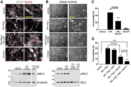 Figure 6. ROCK inhibitors block t-PA/Plgn-induced changes in myosin phosphorylation and morphology in mouse astrocytes and reduce t-PA/Plgn–mediated permeability increase in a human in vitro BBB model. (A) Immunofluorescence images of primary mouse astrocytes treated for 24 hours with vehicle or t-PA (50nM) + Plgn (20nM) in the presence or absence of the Rho kinase inhibitor HA1077 (20μM). GFAP is represented in gray and nuclei in red. Addition of HA1077 fully blocked t-PA/Plgn–induced morphologic changes. Scale bars represent 100 μm. Bottom: representative Western blot demonstrating blockade of t-PA (50nM) + Plgn (100nM)–mediated increase in pMLC in primary mouse astrocytes by HA1077 assessed 2 hours after stimulation of primary mouse astrocytes. (B) Representative phase contrast images showing the blocking effect of Y27632 (20μM) on t-PA (50nM) + Plgn (20nM)–induced morphologic changes in primary mouse astrocytes 24 hours after stimulation. Scale bars represent 100 μm. Bottom: representative Western blot analysis showing a complete inhibition of t-PA (50nM) + Plgn (100nM)–mediated increase in pMLC by Y27632 and by the Rho inhibitor C3 exoenzyme assessed 2 hours after stimulation of primary mouse astrocytes. (C) t-PA (250nM) was added to the luminal chamber of the in vitro human BBB model alone or in combination with HA1077 (20μM, added to both luminal and abluminal chambers). Permeability was assessed after 24 hours. As shown, HA1077 significantly attenuated the ability of t-PA to increase permeability (n = 5). (D) t-PA (25nM) and Plgn (50nM) were added to the luminal chamber of the in vitro human BBB model alone or in combination with HA1077 (20μM, added to both luminal and abluminal chambers) and RAP (0.5μM). Permeability was assessed after 24 hours. As shown, HA1077 significantly reduced the ability of t-PA/Plgn to increase permeability, whereas combination of HA1077 and RAP fully blocked the t-PA/Plgn effect (n = 5).