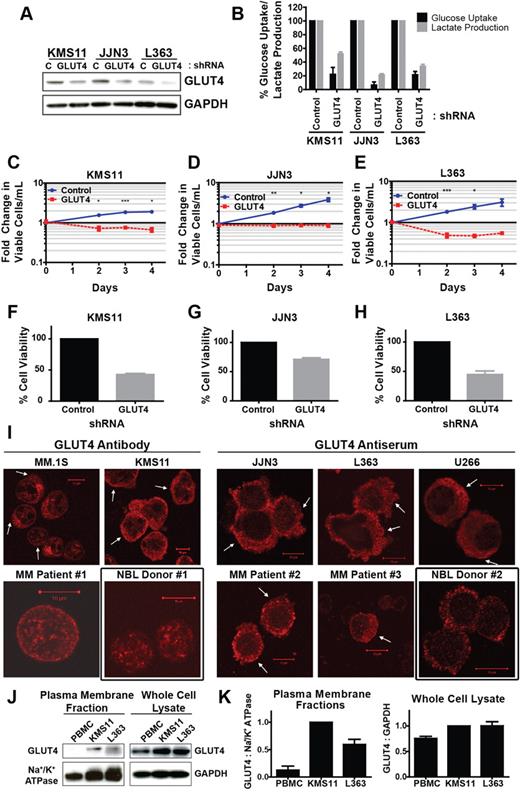 Figure 2. Expression of constitutively plasma membrane-localized GLUT4 is necessary for glucose consumption, lactate production, growth, and viability of myeloma cells. (A) Cells were transduced with control (C), nontargeted shRNA or GLUT4-targeted shRNA and incubated 3 (L363) or 4 (JJN3, KMS11) days before protein extraction, and analysis of GLUT4 protein expression was performed. Representative blot is shown. (B) Cells from panel A were cultured in 5mM glucose-containing medium for 5 hours. Glucose consumption rates and lactate production rates were determined and normalized to control shRNA-expressing cells. (C-E) Cells from panel A were analyzed for viability and proliferation. Viable cell densities are expressed as fold change relative to the day 0 reading of control shRNA-expressing cells. (F-H) Cells from panels C through E were evaluated for viability via trypan blue exclusion. Values are normalized to control shRNA-expressing cells. (I) GLUT4 localization in CD138+ primary myeloma cells, myeloma cell lines, and NBLs was assessed via confocal immunofluorescence microscopy. Arrows indicate regions of cell surface GLUT4 immunoreactivity. Black boxes represent normal controls. Representative images are shown (n = 1 for primary samples). (J) KMS11 cells, L363 cells, and normal PBMCs were lysed for extraction of plasma membrane-associated proteins or total cellular protein content. GLUT4 immunoblot analysis was performed on the resulting fractions. Na+/K+ ATPase and GAPDH serve as loading controls. (K) Densitometric quantification of band intensities in panel G are displayed, normalized first to corresponding loading controls and subsequently to KMS11 cells. (B-H,K) Data are mean ± SEM. With exception noted in panel I, n ≥ 3 for data in panels A through K. *P < .05. **P < .01. ***P < .005.