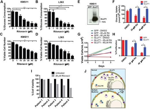 Figure 6. GLUT4-specific glucose transport inhibition elicited by the HIV therapeutic ritonavir suppresses myeloma growth and viability. (A) KMS11 and (B) L363 cells were plated in 5mM glucose medium with ritonavir or DMSO (D) for 17 hours. Glucose consumption rates are normalized to untreated cells (not shown). (C) KMS11 and (D) L363 cells were treated with ritonavir or DMSO for 72 hours. Relative viable cell numbers were determined by MTS assay and normalized to untreated cells (not shown). (E) Stable KMS11 cell lines were generated expressing empty vector or GLUT1 and GLUT1 levels were assessed by immunoblot analysis. Representative blot is shown. N.S. indicates nonspecific band. (F) Stable cell lines from panel E were treated with DMSO or ritonavir (Rit) for 5 hours, and glucose consumption was assessed. (G) Cell proliferation was measured in the stable cell lines described in panel E treated with ritonavir (Rit) or DMSO for 72 hours. A representative experiment is shown. (H) Cell proliferation rates from multiple experiments represented by panel G are normalized to DMSO-treated cells. (I) Primary myeloma cells were treated with DMSO or ritonavir for 72 hours before annexin V/DAPI staining. Values are normalized to DMSO-treated samples (n = 1 for each patient sample). (J) Diagram highlights alterations in glucose transporter regulation between NBLs/plasma cells (top) and MM cells (bottom). (A-D,F,H) Data are mean ± SEM. (A-H) n ≥ 3. *P < .05. **P < .01. ***P < .005.