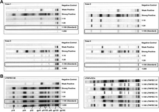 Figure 1. HIV-1 Western blots of the cases were weakly reactive in contrast to the unequivocally positive Western blots of typical LTNPs/ECs. (A) HIV-1 Western blots with controls performed with serial, including standard (1:100; boxes), dilutions of patient sera from each of the cases C1 to C4 to diluent. (B) HIV-1 Western blots with controls performed with serial, including standard (1:100; box), dilutions of patient serum to diluent from one representative LTNP/EC (left), and at the standard dilution for a subset of typical LTNPs/ECs (right).