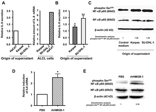Figure 1. Culture supernatant collected from ALK+ALCL cell lines up-regulates IL-8 secretion and NF-κB activation by keratinocytes via HMGB-1 secretion. Culture supernatants were collected from keratinocytes (HaCaT) or ALK+ALCL (Karpas-299 and Su-DHL-1) cells (A) and HaCaT cells exposed to Karpas-299 and SU-DHL-1 cell line supernatants for 24 hours; and (B) IL-8 production was measured by ELISA. IL-8 mRNA levels were also evaluated by qRT-PCR in Karpas-299 (Karpas), SU-DHL-1 and HaCat (keratinocytes) cell lines (A). (C) Western blotting was performed to monitor Ser536 phosphorylation of NF-κB p65 from keratinocytes exposed to Karpas-299 or SU-DHL-1 cell culture supernatants for 24 hours or those exposed to DMEM as a control. qRT-PCR (D) and Western blotting (E) were performed to determine IL-8 mRNA levels and NF-κB activation in keratinocytes treated by the rhHMGB-1 cytokine or not (PBS). Results are expressed as the mean ± SD of 3 independent experiments done in triplicate. *P < .05 and **P < .01 by Student t test.