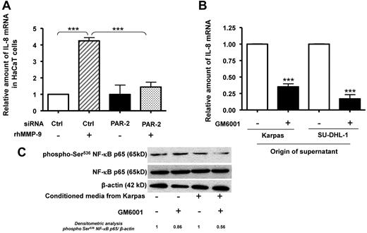 Figure 2. ALK+ALCL cells secrete MMP-9, which enhances IL-8 mRNA expression by keratinocytes through PAR-2 and NF-κB activation. (A) IL-8 mRNA levels were evaluated by qRT-PCR on PAR-2– or control siRNA–transfected HaCaT cells cultured in DMEM supplemented with (+) or without (−) rhMMP-9. (B) HaCaT cells exposed to culture supernatant from Karpas-299 (Karpas) and SU-DHL-1 cells supplemented with 10μM (+) or without (−) MMP inhibitor (GM6001) for 24 hours were collected and IL-8 mRNA measured by qRT-PCR. Results are expressed as the mean ± SD of 3 independent experiments done in triplicate. ***P < .001 by Student t test. (C) Western blotting was performed with anti–NF-κB p65 and anti–phospho-Ser536 NF-κB p65 Abs to determine NF-κB activation in keratinocytes (HaCaT cell line) under the influence of culture supernatant from Karpas-299 cells supplemented with (+) or without (−) GM6001. β-actin was used as a loading control.