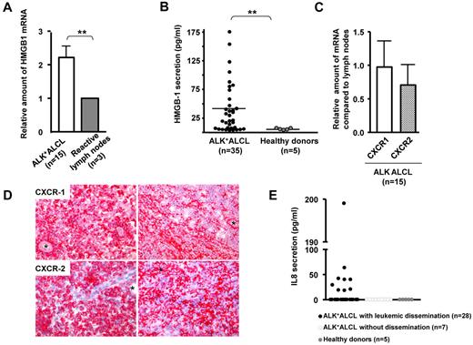 Figure 6. HMGB-1, IL-8, and IL-8 receptor (CXCR1 and CXCR2) expression by ALK+ALCL patients. HMGB-1 (A) or CXCR1 and CXCR2 (C) mRNAs levels were evaluated by qRT-PCR on 15 ALK+ALCL biopsies. mRNA amounts were normalized to levels found in reactive lymph nodes. Results are expressed as the mean ± SD of independent experiments done in triplicate. **P < .01 by Student t test. (B,E) HMGB1 and IL-8 secretion was measured using an ELISA assay on sera from 35 ALK+ALCL patients with (n = 20) or without (n = 7) leukemic dissemination and from healthy patients (n = 10). The number of biopsies in each group corresponds to the n value. (D) CXCR1 and CXCR2 immunohistochemical staining of lymph nodes from 2 ALK+ALCL patients. Sections were stained with anti-CXCR1 or anti-CXCR2 Abs, and nuclei were counterstained with hematoxylin. Vessels were positive for both CXCR staining and were used as an internal control (asterisks). Staining intensity varies from tumoral cell to cell. Original magnification, 200×.