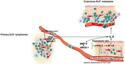 Figure 7. Schematic overview. Shown is a schematic diagram of the possible relationship among the pro-inflammatory mediator HMGB-1, MMP-9, PAR-2, and the chemokine IL-8 to establish a hyperplastic environment within the skin that might participate in ALK+ lymphoma cell epidermotropism and cutaneous metastasis development. Solid arrows indicate pathways established by our data; dashed arrows are currently supported only by circumstantial evidence and remain to be experimentally validated. Illustration done by Servier Medical Art (http://www.servier.fr/servier-medical-art).