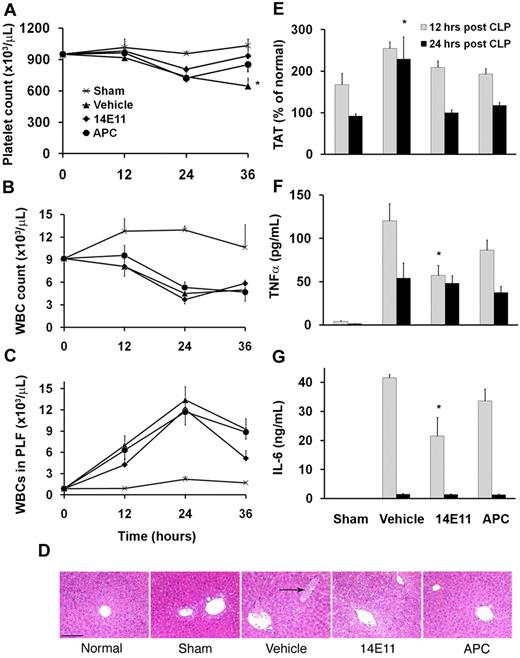 Figure 3. Effects of 14E11 and APC treatment on coagulation and inflammation. Mice treated with 14E11 have less platelet consumption and decreased inflammation after CLP sepsis. (A) Platelet counts were measured in cohorts killed at designated time points after CLP (n = 7 or 8 for each group per time point). Vehicle-treated mice show a progressive drop in platelet count after bowel perforation (36 hours after infection). *P < .05 (vehicle vs sham). (B) All CLP groups show a similar decrease in circulating leukocytes (WBCs) and (C) similar migration of leukocytes into the peritoneal cavity. (D) Microscopic images of representative liver sections from normal, sham-operated, and vehicle-, 14E11-, and APC-treated septic mice (hematoxylin and eosin stain). For histologic evaluation, all animals received vehicle, APC, and 14E11 immediately after CLP (0 hours). Mice were killed 36 hours after CLP, saline perfused, and the organs were fixed in 10% zinc-buffered formalin. Vehicle-treated mice show multifocal thrombosis in the liver, whereas 14E11- and APC-treated mice had a lower density of occluded vessels per field. Histologic sections were visualized with a Nikon Optiphot-2 upright microscope using a 10× objective. Bright-field images were captured with a Hitachi HV-C20 CCD camera and processed using SPOT Basic Version 3.5.0 software. Scale bar represents 150 μm. (E) TAT levels in the plasma are elevated for all groups at 12 hours after surgery, and TAT remains elevated in the vehicle-treated group at 24 hours, suggesting sustained thrombin generation. *P < .05 (vehicle vs sham). (F) TNF-α and (G) IL-6 levels are increased in vehicle-treated mice compared with 14E11-treated animals 12 hours after CLP (n = 7 or 8 for each group per time point), suggesting an anti-inflammatory mechanism for 14E11 during sepsis. *P < .05. Data are mean ± SEM.