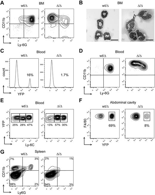 Figure 3. Cebpa-Cre–driven deletion of Dicer1 causes neutrophil dysplasia and monocyte/macrophage depletion in mice. (A) FACS analysis of BM neutrophils with Abs against CD11b and Ly-6G for Dicer1wt/Δ (similar to Dicer1wt) and Dicer1Δ/Δ neutrophils. (B) Micrographs showing morphology of Dicer1wt/Δ (similar to Dicer1wt) and Dicer1Δ/Δ neutrophils. Black bar indicates 10 μm. (C) Percentage of EYFP+ cells in the blood of Dicer1wt/Δ and Dicer1Δ/Δ mice. (D) Analysis of peripheral neutrophils with Abs against CD11b and Ly-6G. (E) Analysis of peripheral EYFP+ monocytes (CD11b+ or Ly-6G−) with Abs against Ly-6C. (F) Analysis of EYFP+ macrophages from the abdominal cavity with Abs against F4/80 Ag. (G) FACS analysis of total spleen cells with Abs against CD11b and Ly6G. All analyses were performed on at least 3 mice.