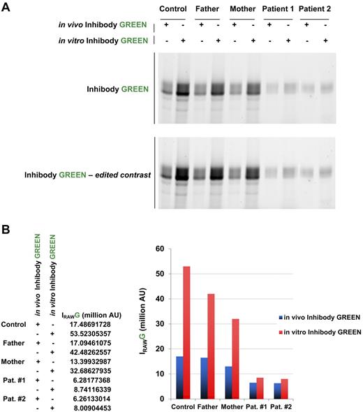 Figure 5. Characteristics of mutant D137N acid β-glucosidase. (A) In vivo labeling of active acid β-glucosidase in intact skin fibroblasts (10nM inhibody, green) compared with total labeling in vitro (cell lysates of untreated cells). (B) Quantification of gels shown in panel A.