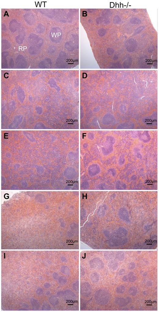 Figure 7. Histology showing red and WP areas in Dhh−/− and WT spleens, before and after induction of stress-induced erythropoiesis. Parafin-embedded spleen sections were stained with hematoxilin and eosin, to identify WP areas, which stained deeper purple, and RP areas, which stained pink. Typical WP and RP are illustrated in panel A. Left column (A,C,E,G,I) represents typical histology in WT spleens; and right column (B,D,F,H,J), typical histology in Dhh−/− spleen, without treatment (A-B) and during a time course after induction of stress erythropoiesis after PHZ treatment, on day 5 (C-D), day 7 (E-F), day 9 (G-H), and day 14 (I-J). Scale is shown.