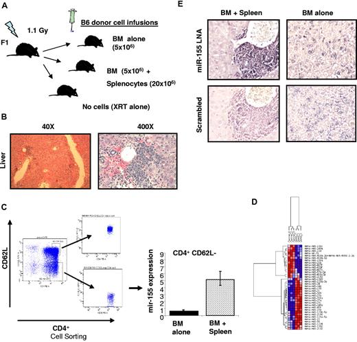 Figure 1. miR-155 expression is up-regulated in effectors T cells of mice recipients with aGVHD. (A) Schematic presentation showing aGVHD murine model used. (B) Histopathologic evaluation of a representative liver sample collected from a mouse with clinical score of GVHD of more than or equal to 7. This section was stained with hematoxylin and eosin (original magnification ×40 and ×400). (C) Average miR-155 expression in CD4+ CD62L− T cells isolated from the spleen of 3 recipient mice with aGVHD (BM + spleen) or controls (BM alone). The results shown represent the average of 3 independent mouse samples performed each in triplicate. Values are expressed as relative miRNA expression after 2ΔCt calculations and normalization with sno135. Bars represent SD. (D) Hierarchical clustering analysis of miRNA expression obtained using Nanostring from CD4+ CD62L− T cells isolated from the spleen of recipient mice with aGVHD (BM + spleen) or controls (BM alone). Color areas indicate relative expression of each miRNA among the 2 type of samples (red high, blue low expression). (E) Histopathologic and molecular evaluation of a representative liver sample collected from a mouse with clinical score of GVHD of more than or equal to 7 or a control mouse (BM alone). At least 3 mice in each group were evaluated for staining with LNA anti–miR-155 and scramble control. These sections were stained with LNA anti–miR-155 probes or scrambled controls. Dark staining indicates positivity (original magnification ×400). Note the strong staining of the mononuclear cells in the periportal lymphoid aggregate in the BM + spleen mouse that is lost in the same cells in the serial section with the scrambled probe.