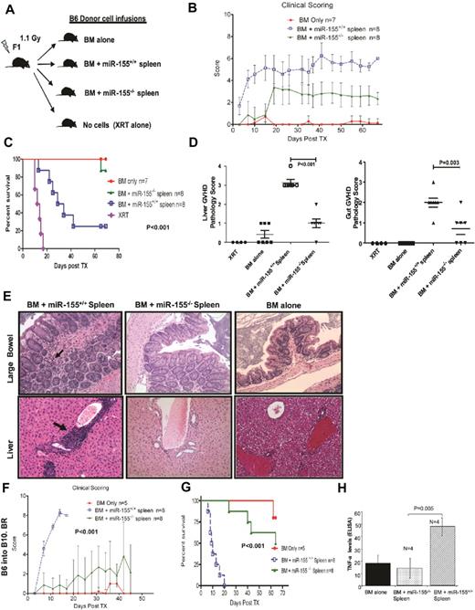Figure 2. Recipients from miR-155–deficient splenocytes do not develop severe aGVHD and have increased survival. (A) Schematic presentation showing the different donor cells used in lethally irradiated F1 mice. (B) Clinical scores from the different recipient mice groups after transplantation. (C) Survival rate of lethally irradiated mice receiving BM alone, BM + miR-155−/− spleen, BM + miR-155+/+ spleen, or XRT alone. Data represent 2 independent experiments. (D) Histopathologic GVHD scores of recipient tissues. A second cohort of mice was used for histopathologic analysis. Fifteen days after transplantation (except for XRT group), mice from the indicated groups were killed and sections of the large bowel and liver were stained with H&E. Data are pooled from 2 independent experiments, representing approximately 6 or 7 animals per group, the XRT group that had 4 mice. There was no significant difference in the liver GVHD scores between the BM alone and BM + miR-155−/− spleen recipients (P = .07). The GVHD scores in the gut were higher in the BM + miR-155−/− spleen recipients versus the BM alone (P = .04). (E) Histopathologic evaluation of representative liver and large-bowel samples collected from the different recipient mice groups at day 15 after transplantation. The arrows in the large-bowel slide from the B6 BM + miR-155+/+ spleen F1 recipients showed lymphoplasmacytic infiltration in the lamina propia with frequent apoptosis The arrows in the liver slide from the same F1 recipients showed abundant lymphocytes infiltrating around the portal vein. No significant pathology is shown in BM alone and miR-155−/− groups. (F) Clinical GVHD scores after transplantation from lethally irradiated B10.BR recipients transplanted with BM alone, BM + miR-155−/−, or BM + miR-155+/+ spleen. (G) Survival rate of the different recipient B10.BR mice groups. (H) TNF-α levels measured in the serum of lethally irradiated F1 recipients of BM alone, BM + miR-155−/− spleen, and BM + miR-155+/+ spleen, 15 days after transplantation. Samples were assayed in triplicate and results are shown as the means from 4 biologic samples within a group.