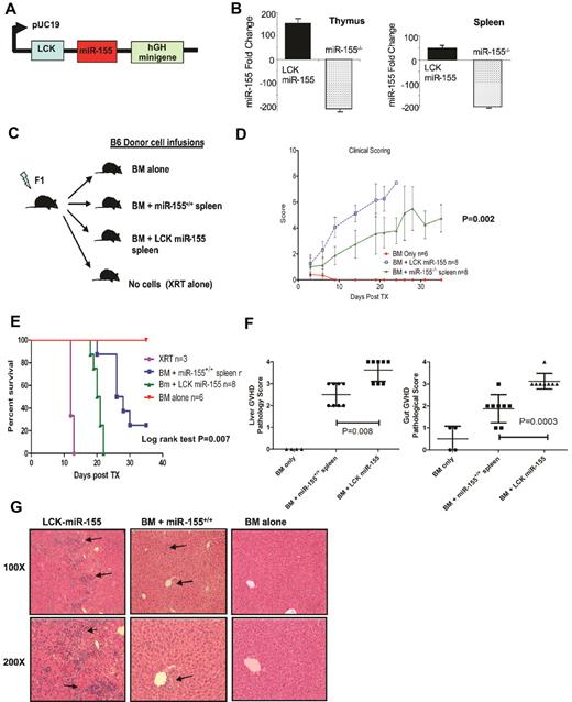 Figure 3. Recipient mice from donor splenocytes overexpressing miR-155 in T cells exhibit rapidly evolving aGVHD and short survival. (A) Schematic presentation showing the construct used to generate the LCK-miR-155 mice. (B) miR-155 expression (fold change) in the thymus and spleen from age- and sex-matched B6 LCK–miR-155 transgenic mice and B6 miR-155−/− mice. Bars represent SD. (C) Schematic presentation depicting the different recipients F1 mice groups. (D) Clinical GVHD scores after transplantation from lethally irradiated F1 recipients transplanted with BM alone (n = 8), BM + LCK–miR-155 (n = 8), or BM + miR-155+/+ (n = 8) splenocytes. P values were obtained by using t test. (E) Survival rate of the different recipient F1 mice groups. Comparisons between BM + miR-155−/− spleen and BM + miR-155+/+ spleen survival curves were performed using log-rank test. (F) Histopathologic GVHD scores of recipient tissues. A second cohort of mice was used for histopathologic analysis. Fourteen days after transplantation, mice from the indicated groups were killed and sections of the large bowel and liver were stained with H&E. P values were obtained by using t test. (G) Histopathologic evaluation of representative liver samples obtained from recipients of BM alone, BM + miR-155+/+ spleen, and BM + LCK-miR-155 donor cells. Slides were stained with H&E. The arrows indicate lymphocytic infiltration in the recipient livers characteristic of GVHD.