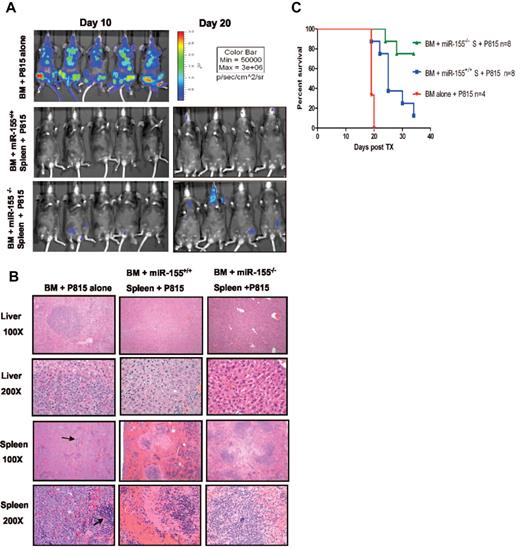 Figure 6. miR-155 deficiency in donor T cells does not abrogate GVL effects. (A) Whole body bioluminescent signal intensity of recipient mice. Mice were imaged on day 10 and day 20. (B) Histopathologic analysis of spleen and liver tissues of the different mice cohorts. Histopathologic examination at lower power (original magnification ×100) revealed extensive nodular leukemic infiltration in the liver in the BM alone recipients, whereas no infiltrates were seen in recipients who received splenocytes, either from WT or miR-155–deficient mice (top panels). Middle top panels: The same liver sections are shown at larger magnification (original magnification ×200). Note in the BM alone the many large anaplastic cells with pleomorphic, multilobular large nuclei and frequent mitosis figures. Last 2 bottom panels: Spleen sections at lower (top) and higher (bottom) magnification. Note the complete replacement of the spleen by the large anaplastic cells in the BM alone group. The arrows point to normal spleen. There were no leukemic infiltrations in the recipient groups who received either WT or miR-155–deficient splenocytes. (C) Survival of lethally irradiated mice transplanted with WT or miR-155–deficient splenocytes plus BM P815 leukemic cells. Survival comparisons were performed using the log-rank test.