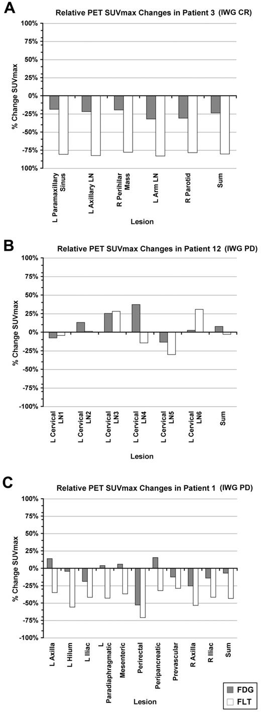 Figure 2. Percent change in FDG- and FLT-PET SUVmax for individual lesions for representative patients. The percentage change in summed SUVmax for the designated lesions is also shown. (A) Patient 3. (B) Patient 12. (C) Patient 1. L indicates left; LN, lymph node; and R, right.
