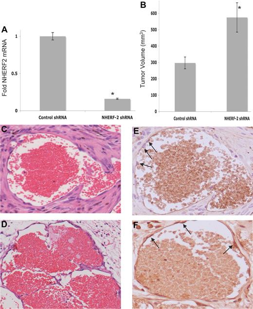 Figure 5. Effect of silencing NHERF-2 on in vivo tumorigenesis. (A) Efficient knockdown of NHERF-2 in bEnd.3 cells by lentiviral shRNA as determined by real-time PCR. (B) Average tumor volume (in mm3) in control shRNA- versus NHERF-2 shRNA-bearing groups. Ten mice were injected with 1 × 106 cells, and animals were killed on day 14. Statistical significance was determined with 2-sided Student t test, and *P < .05 was considered significant. (C) Histologic analysis by H&E staining found typical cavernous hemangiomas in control-shRNA and (D) NHERF-2 shRNA–bearing groups. Original magnification, ×20. (E) Ki67 staining of the control shRNA–bearing hemangioma. Arrows indicate lack of Ki67 (brown) staining; instead hematoxylin counter-stained blue nuclei are visible. (F) Ki67 staining of the NHERF-2 shRNA–bearing hemangioma. Arrows indicate positive Ki67 (brown) staining. Original magnification, ×40.
