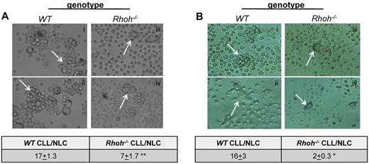Figure 2. Impaired cell-cell contact of Eμ-TCL1Tg;Rhoh−/−CLL and NLCs. (A-B) show colocalization of murine NLCs with CLL cells (arrowheads) in representative bright-field photomicrographs of WT and Rhoh−/− (A) spleen cells and (B) PBMNCs of Eμ-TCL1Tg animals at 200× magnification (n = 2-4). The table for each panel indicates number of CLL cells colocalized per NLC enumerated in 2 randomly selected microscopic fields at 200× magnification (WT versus Rhoh−/−; mean ± SEM, **P = .0001 and *P = .001, Student t test).